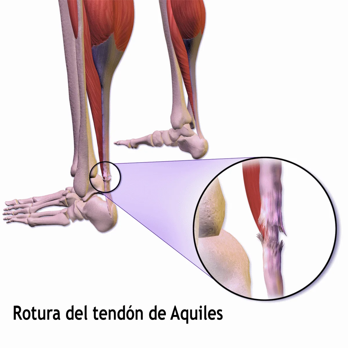 ¿El colágeno funciona igual para el tendón que para la artrosis de rodilla?
